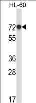 WB - RBM39 Antibody (N-term) AP14119a